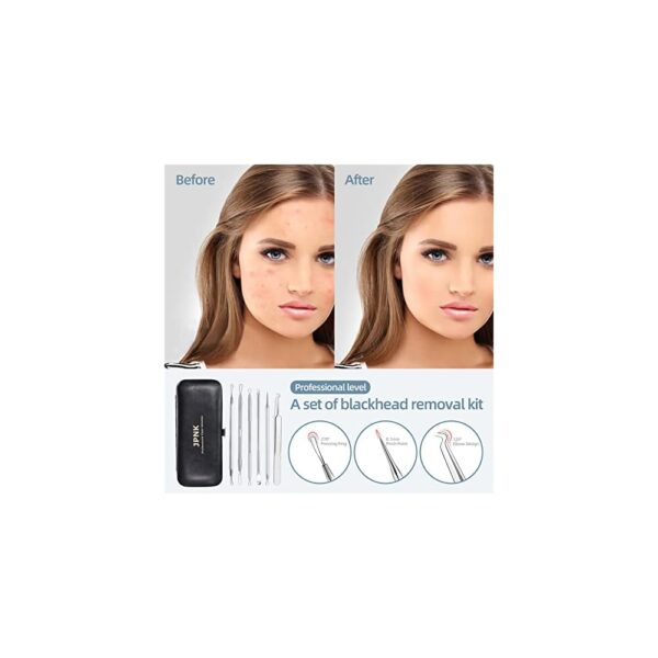 JPNK 6-Piece Blackhead Remover Tool Kit with Leather Case – Professional Stainless Steel Comedone Extractor Set - Image 3
