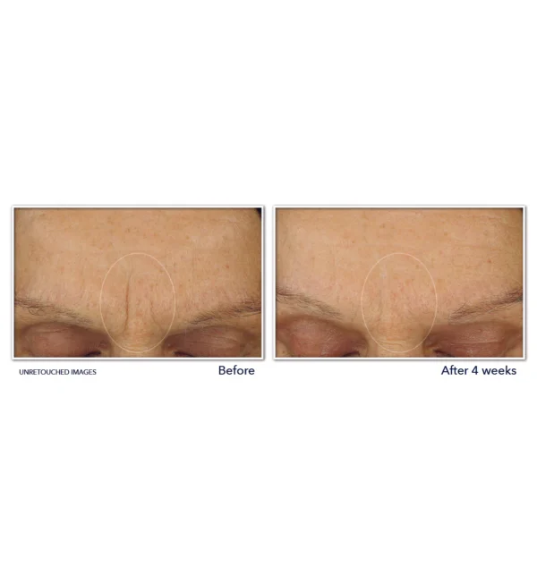 RoC Retinol Correxion Max Daily Hydration Anti-Aging Face Moisturizer – Deep Hydration & Wrinkle-Reducing Formula with Retinol - Image 2