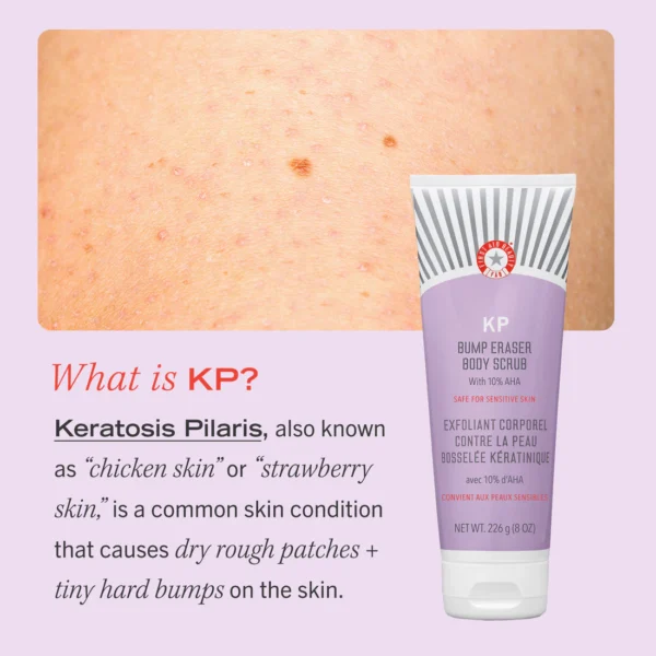 First Aid Beauty KP Bump Eraser Body Scrub – Exfoliating Scrub for Smooth, Clear Skin - Image 3